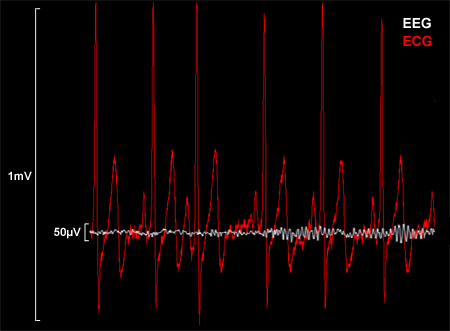 EEG vs ECG Amplitude